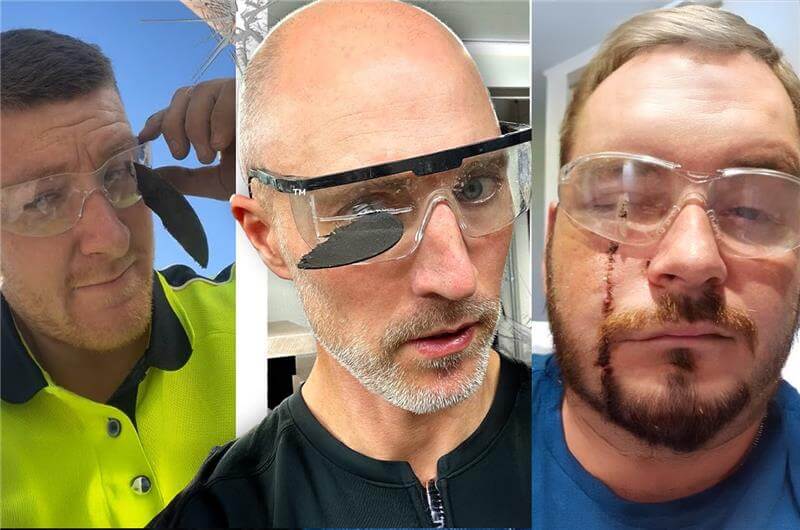 Eye Injury Response: Are You Prepared to Act Quickly and Safely?